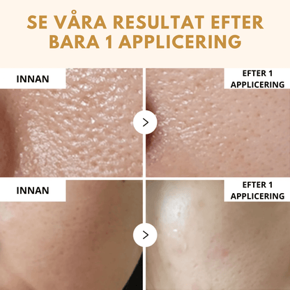 Dr. Melaxin - Complete Skin Reset